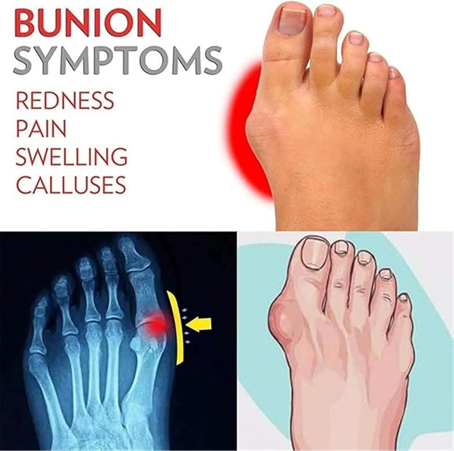 Summer Slip-On Leather Durable Bunion Relief Men's Walking Sandals, Snake Pattern Open Toe Non- Slip Breathable Plantar Fasciitis Slippers, for Dad on Christmas Birthday Fathers Day