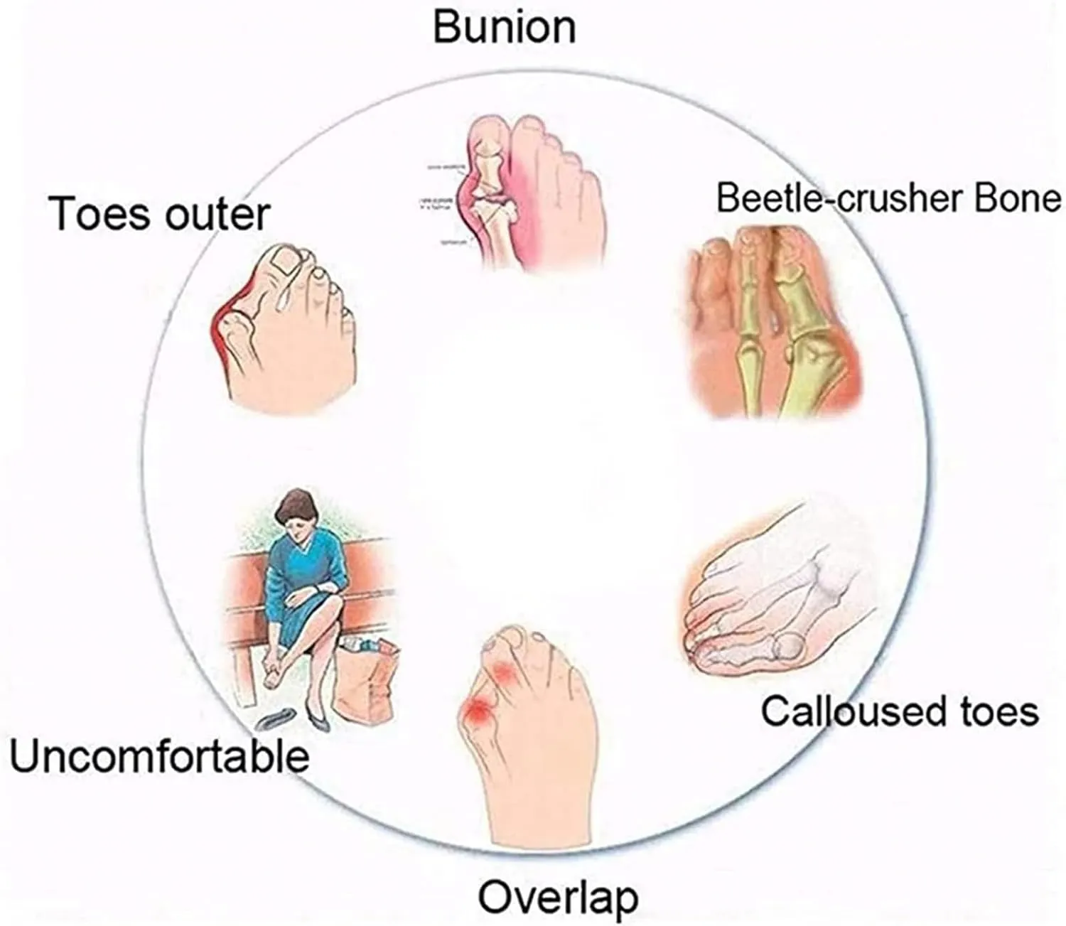 Women's Bunion Corrector Sandals For Hallux Valgus,Outdoor Orthopedic Beach Slippers,Stylish Plantar Fasciitis Wedge Flip Flops